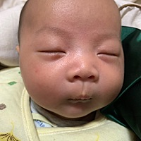 懂得人帮我看下眼脸处是不是胎记，问过医生说不是，也不是血管瘤，那这是啥，会消失吗？