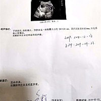 第一胎女孩，第二胎，最近压力很大，婆婆公公想要男孩，放一张第八周做的B超单，自己感觉是个女孩，大家...