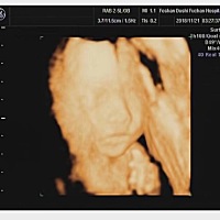 宝宝的四维照和出生时候的照片，像不像？