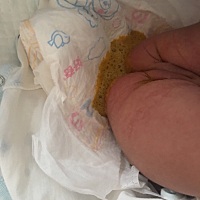 各位宝妈有没有遇到过宝宝拉大便呈泡沫状的情况，求教 睡觉有时会脖子后面出好多汗，不知道该不该给她减...