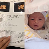 14号下午五点26侧切生男宝一枚，四天了伤口走路还是疼。生产打的无痛分娩对我完全没用，无语死了，打的...