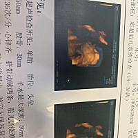 着急哦 有没有人看得出这是男宝还是女宝