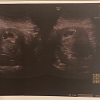 谁会看7周的b超单，看看是男孩女孩，谢谢