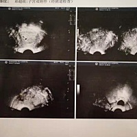 医生说双胞胎，有谁会看的呀？