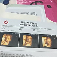 通过了  不用担心了   就是小一周   不过宝宝好就可以了