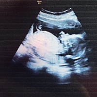 春暖花开，如愿以偿，凑了一个好字