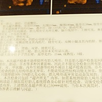 宝宝24周做的四维彩超。各位宝妈，帮我看看，是男宝还是女宝？