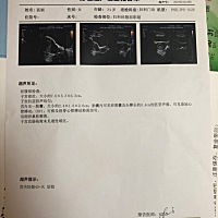 3月15号 恶心头痛