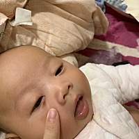 这个到底是不是胎记呀？满月才出现的