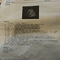 二胎了，有经验的宝妈帮忙看看是男宝女宝？