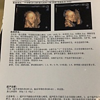 大家帮忙看看是佩琦还是乔治？
