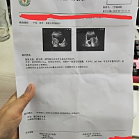 怀孕7周，这个正常吗，有点担心