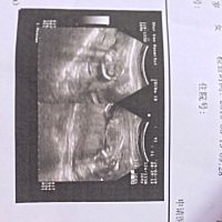 哈哈男孩还是女孩