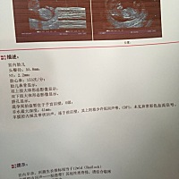 有看得懂的宝妈？不知道要不要紧？