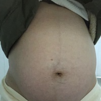 来接男宝宝，37周➕5，我的男宝宝就迫不及待的与我见面了～肚脐从一开始凹的后面凸起，有腰身，下怀，正...