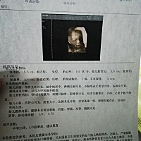 什么是SD值增高