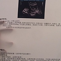 昨天检查说宫腔积液。之前40多天的时候有点出血打了五天黄体酮就没有出血了。八周➕的时候做彩超没有宫...