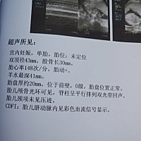 谁会看这个，第二次 B超，＋唐氏筛查一起花了1300，现在是不是消费都提高了😂😂