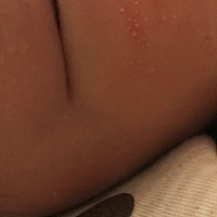 哪位宝妈知道这是什么疙瘩，有时红有时不红，里面有个白色的……