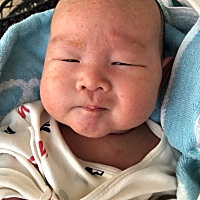 请问下我宝宝从出生半个月脸上一直有这个，是湿疹吗？
