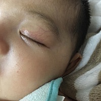 有没有宝妈知道宝宝脸上一块白一块黄的是怎么回事呢？ 鼻子旁边白的 脸颊黄黄的