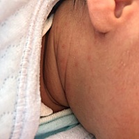 我女儿这脖子里起的是什么？