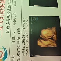 今天做了四维，宝宝超级配合，不到十分钟就完成了，宝贝真乖，大家帮我看看是男宝还是女宝呀