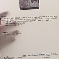 希望两个小家伙 平安 健康  不要在折腾你老娘亲了 每天不想吃东西 为了你们强逼着自己吃！