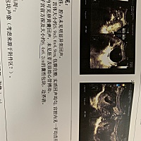 第一次B超检查有囊肿，好担心。有什么饮食调节的办法吗？