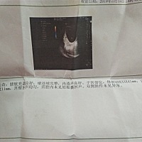 怀孕是不是从月经末次后排卵期算起？而不是月经末次那天。我1月25月经末次，但是现在都3月20日了，b超单...