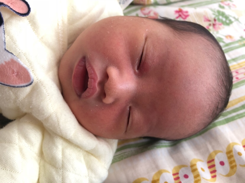 出生到现在第七天上眼皮一块红红的 一直红没有消退的迹象 有没有同款宝妈啊😫😫哭闹的时候整个zh