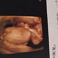 四维照了，会看男女的，帮忙看看