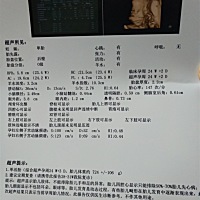 帮我看男的还是女的