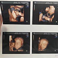 2宝4维像吗？帮我看看图一，二宝，图二大宝。像吗？