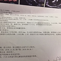一胎是儿子，这胎比较好奇是男定女，这个看得到男女吗？