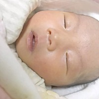 宝宝嘴唇看着有点干 新手妈妈不懂 宝宝的嘴唇这样正常吗