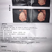 今天去拍了四维通过了终于放心一点了，就是小家伙太不配合了屁股朝上就是不露脸趴着的，为娘爬了半天楼...