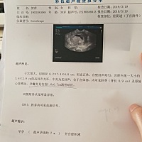 有类似情况的孕妈么？这个积液能够自己吸收干净的吧，因为前几天有过出血。天天担忧着。