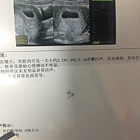 怎么看孕囊测试男女宝宝呀，求助