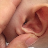 有宝妈遇到过吗，宝宝耳朵长了个像小米粒的东西，是什么呀？