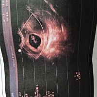 今天是第9周了。😘 几代下来都没有女儿福。希望我怀的是女宝宝