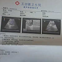 看心率应该是个小情人吧🙆