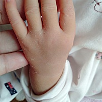 宝妈们帮看看会不会好黄！！！我天天看也看不出什么来。好担心黄疸高，现在又不方便去医院