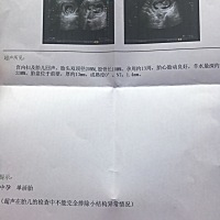 NT通过啦！进来帮忙看看是乔治还是佩琪？