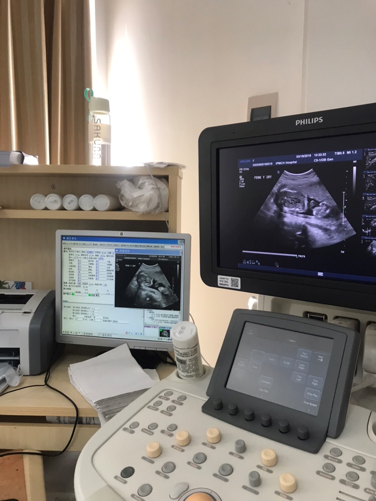 各位宝妈帮我看一下，这是胎宝宝的什么部位照片？