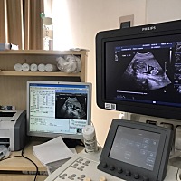 各位宝妈帮我看一下，这是胎宝宝的什么部位照片？