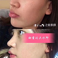 嗯？变白？算逆袭吗？