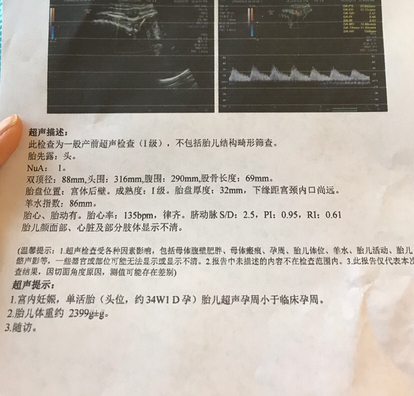 我的宝宝是不是不健康啊 为什么偏小这么多 有经验的宝妈帮我看看好吗？