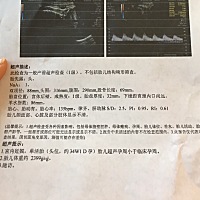 有比我宝宝数据更偏小的宝妈吗？ 我的宝宝是不是不健康啊 为什么偏小这么多 有经验的宝妈帮我看看好吗？