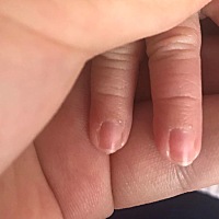 宝妈们知道这是啥吗，一个手四个手指都有，另一个手一个手指头有，这个白色的